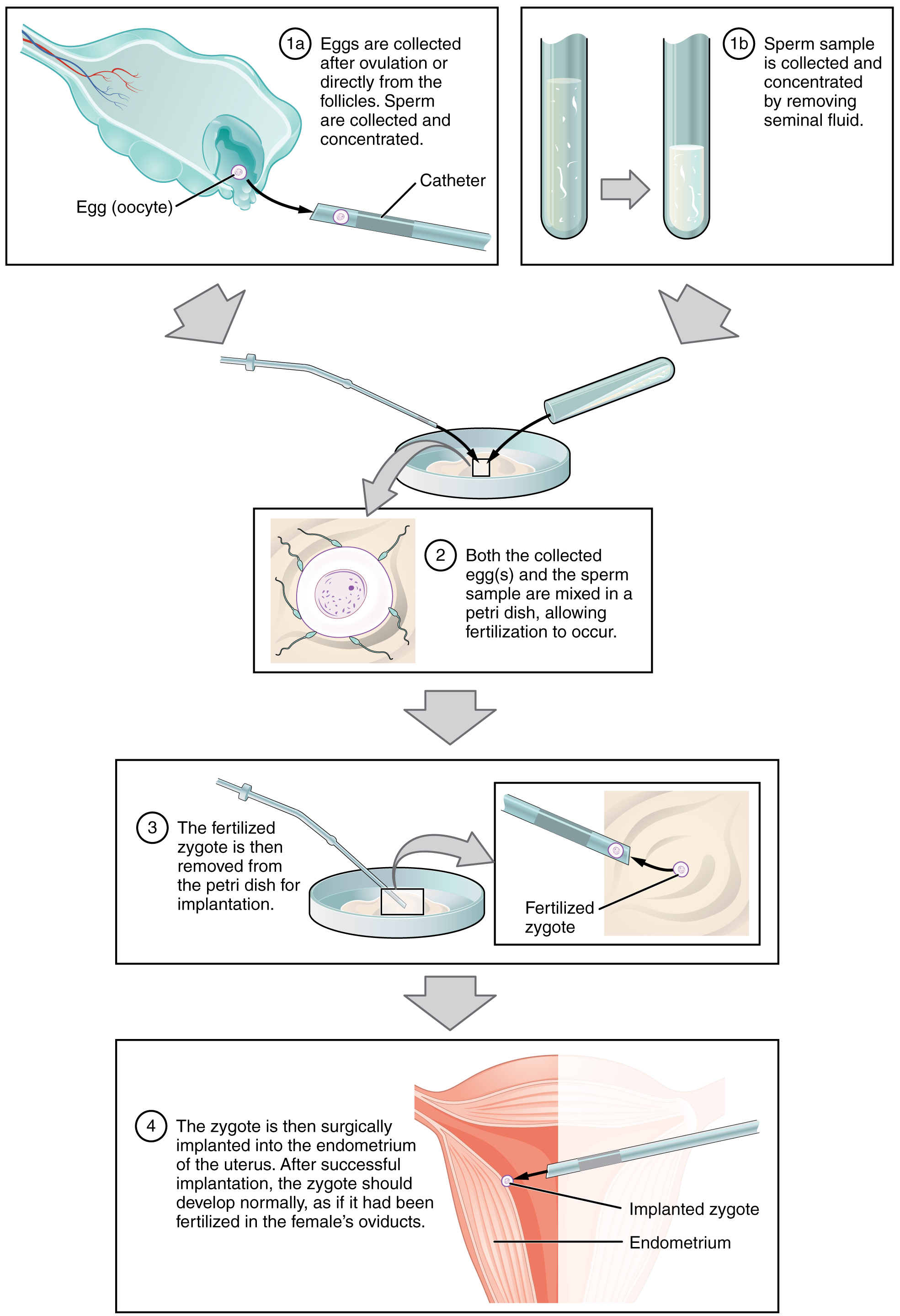 4. Lợi Ích Của IVF?