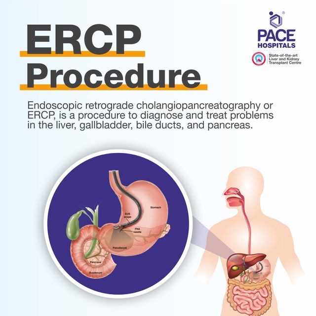 3. Những rủi ro khi thực hiện thủ thuật ERCP